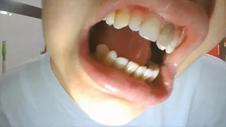 monday teeth show