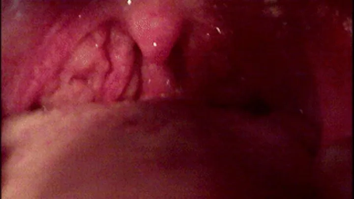 My mouth, throat, and swollen tonsils