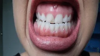 Teeth and Gums