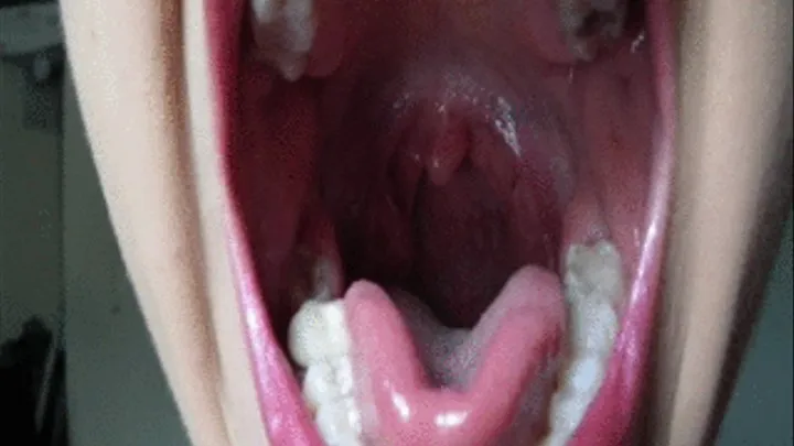 Inside mouth into Throat