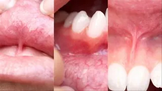 HD Veins On My Lips + Teeth And Gums [Request]