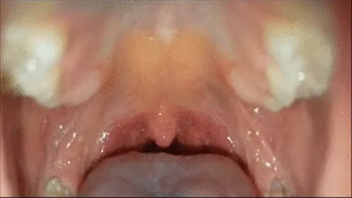 Singing Uvula