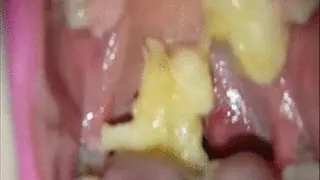 Banana Covered Uvula