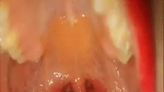 Yawning Uvula
