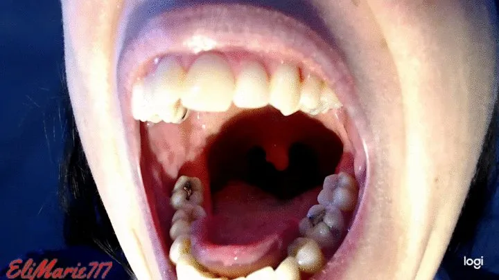 Uvula Dancing