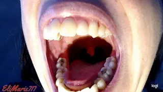 Uvula Dancing