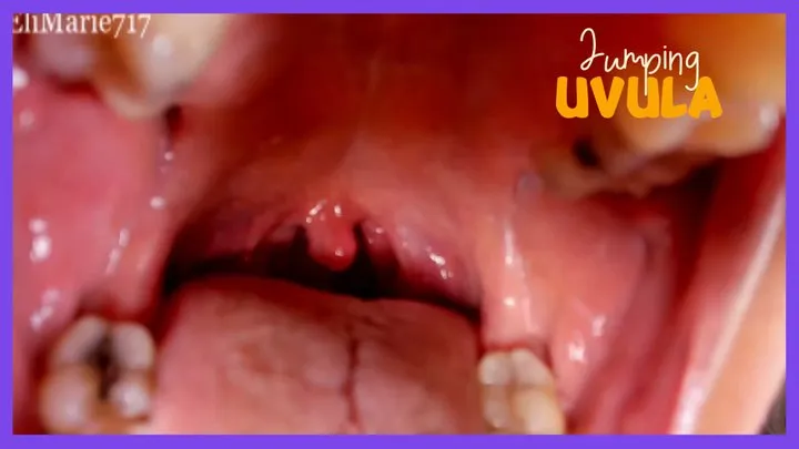 Jumping Uvula