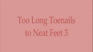 Too Long Toenails to Neat Feet 3