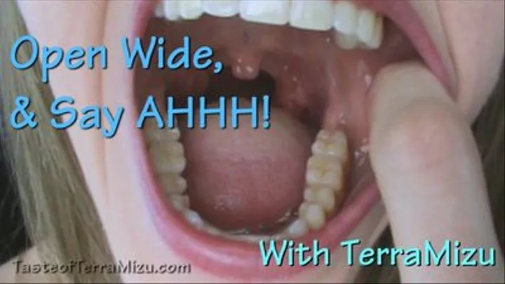 Open Wide & Say AHHH! - TerraMizu