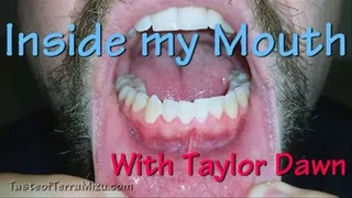 Inside my Mouth - Taylor