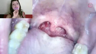 Endoscope mouth tour -Miss Quin