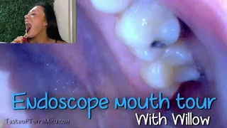 Endoscope Mouth Tour - Willow Lansky