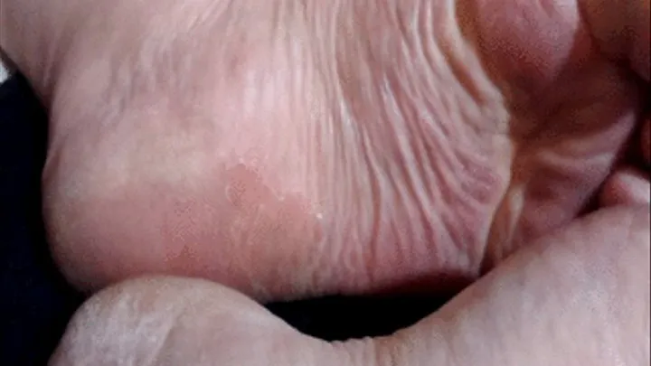 Poor dry wrinkly sole