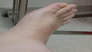 Clamping toes in hospital