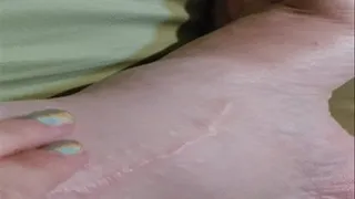 massaging swollen ankle