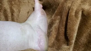 swollen dirty crusty soles