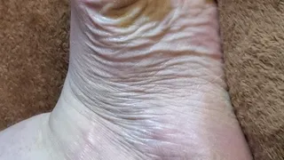 Wiggling toes and showing off calloused and wrinkled sole