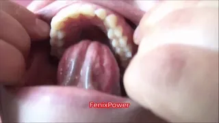 Teeth and gums [ZOE]