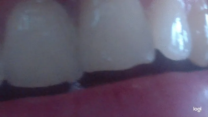 My teeth in extremly close up to cam