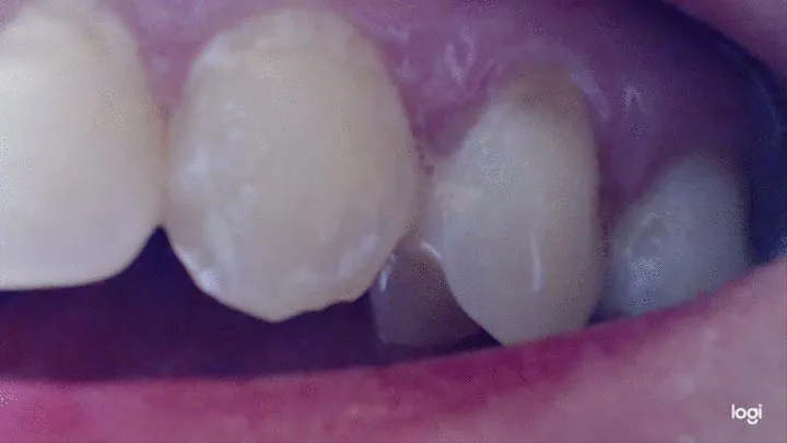 5 minutes of my teeth to cam in close up