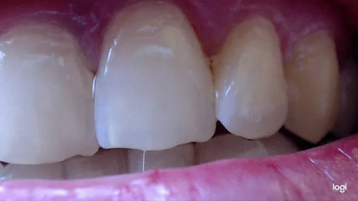 5 minutes with natural pearl teeth in close up to cam