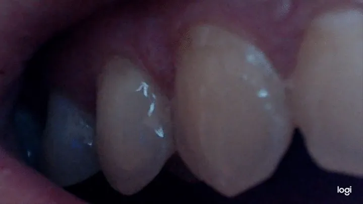 My teeth in extremly big close up to cam