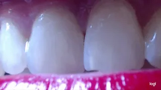 6 minutes teeth in close up to cam