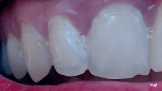 My wonderful teeth in close up