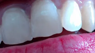 5 minutes my wonder white natural teeth