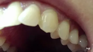 10 minutes white teeth to cam