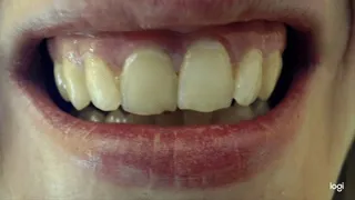 7 minutes with my white natural teeth in close up