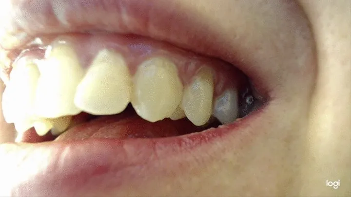 11 minutes normal video teeth in close up big