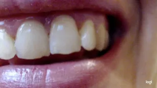 Pointy, nice and white teeth in close up