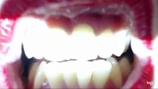 My long video with white teeth to cam