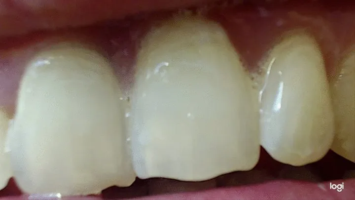 7 minutes teeth to cam in extremly close up