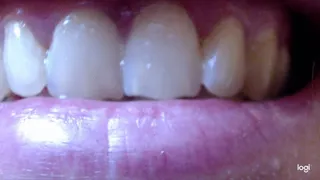 My sweet white natural teeth in close up to cam