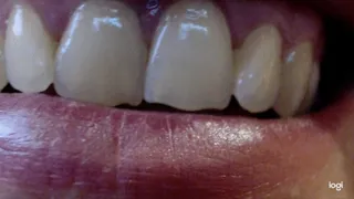 5 minutes white teeth to cam in extremly close up