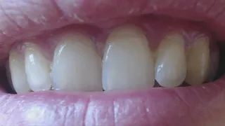 6 minutes with my awesome white and shiny teeth in close up