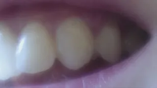 6 minutes extremly close up of my canines to cam - big zoom and view