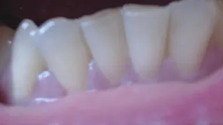 Wonderful white teeth in big zoom to cam for You
