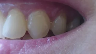 35 minutes of teeth in extremly close up to cam