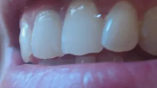 13 minutes my teeth in big close up to cam
