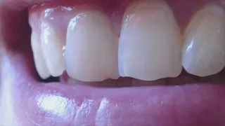 15 minutes my white natural and feminine teeth to cam