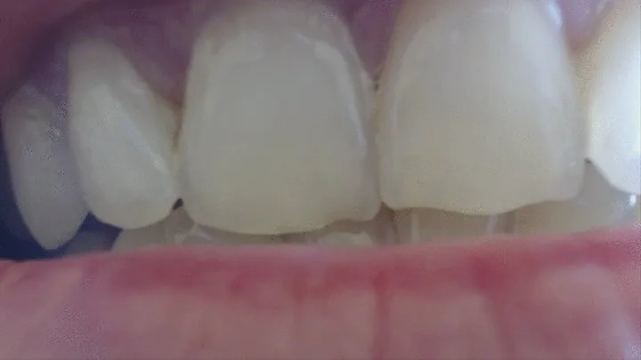 22 minutes my teeth from various views to cam