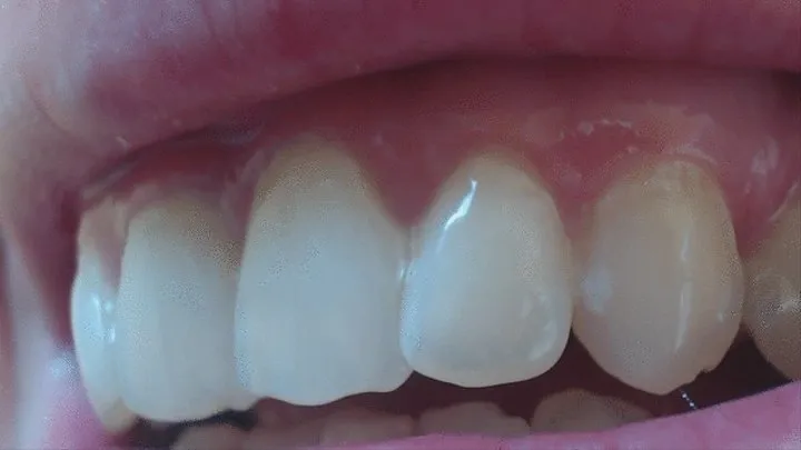 19 minutes teeth in big zoom to cam