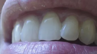 3 minutes with extremly white and shiny teeth in extremly close - up