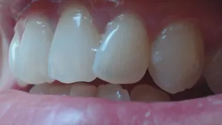 5 minutes with extremly white teeth in extremly close up to cam