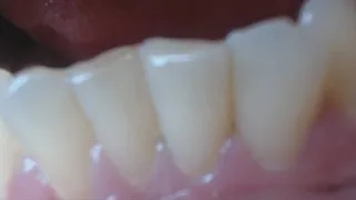 3 minutes with my today shiny, white and pointy teeth to cam for You