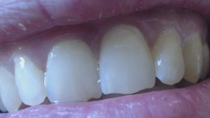 5 minutes with my normal awesome teeth in close up