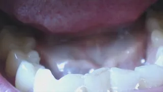 6 minutes teeth in extremly close up to cam